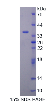 酪氨酸3-磷酸肌醇雙銜接因子(DAPP1)重組蛋白,Recombinant Dual Adaptor Of Phosphotyrosine And 3-Phosphoinositides (DAPP1)