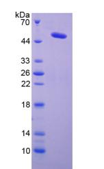 賴氨酰氧化酶(LOX)重組蛋白,Recombinant Lysyl Oxidase (LOX)