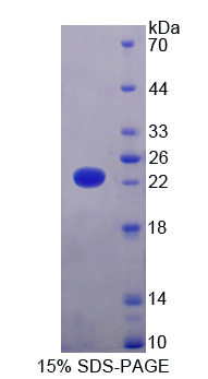 賴氨酸特異性去甲基化酶4A(KDM4A)重組蛋白,Recombinant Lysine Specific Demethylase 4A (KDM4A)