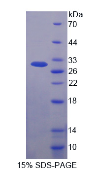 赖氨酸tRNA合成酶(KARS)重组蛋白,Recombinant Lysyl tRNA Synthetase (KARS)