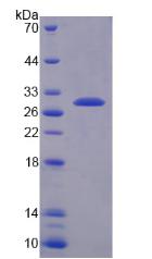 醌型二氢蝶啶还原酶(QDPR)重组蛋白,Recombinant Quinoid Dihydropteridine Reductase (QDPR)