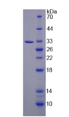 醌NADH脱氢酶1(NQO1)重组蛋白,Recombinant NADH Dehydrogenase, Quinone 1 (NQO1)