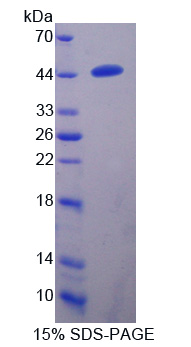 跨膜丝氨酸蛋白酶4(TMPRSS4)重组蛋白,Recombinant Transmembrane Protease, Serine 4 (TMPRSS4)