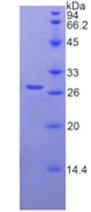 跨膜丝氨酸蛋白酶2(TMPRSS2)重组蛋白,Recombinant Transmembrane Protease, Serine 2 (TMPRSS2)