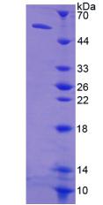 可溶性胸苷激酶1(TK1)重组蛋白,Recombinant Thymidine Kinase 1, Soluble (TK1)