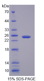 可溶性半乳糖凝集素3结合蛋白(LGALS3BP)重组蛋白,Recombinant Lectin Galactoside Binding, Soluble 3 Binding Protein (LGALS3BP)