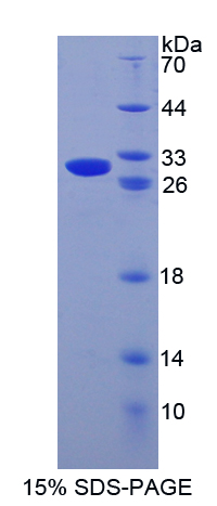 颗粒酶B(GZMB)重组蛋白,Recombinant Granzyme B (GZMB)