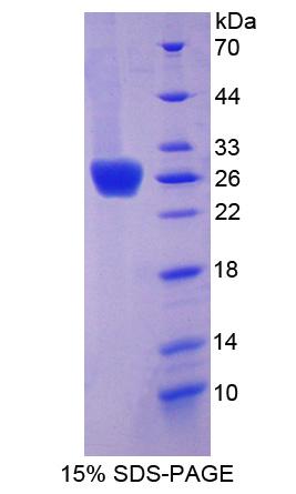 柯萨奇病毒腺病毒受体(CXADR)重组蛋白,Recombinant Coxsackie Virus And Adenovirus Receptor (CXADR)