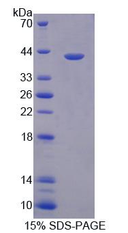 抗原肽转运蛋白1(TAP1)重组蛋白,Recombinant Antigen Peptide Transporter 1 (TAP1)