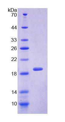 抗药蛋白(SRI)重组蛋白,Recombinant Sorcin (SRI)