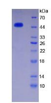 抗凝血酶(AT)重組蛋白,Recombinant Antithrombin (AT)