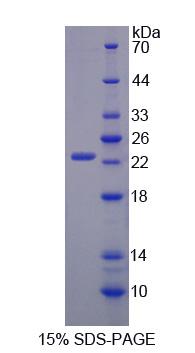 卷曲域锚蛋白重复序列葡萄膜自身抗原(UACA)重组蛋白,Recombinant Uveal Autoantigen With Coiled Coil Domains And Ankyrin Repeats (UACA)