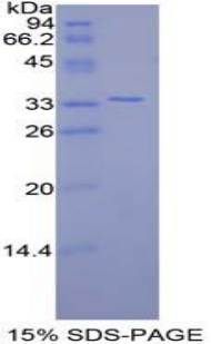 卷曲同源物10(FZD10)重组蛋白,Recombinant Frizzled Homolog 10 (FZD10)