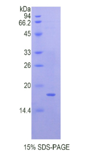 静止素Q6硫基氧化酶1(QSOX1)重组蛋白,Recombinant Quiescin Q6 Sulfhydryl Oxidase 1 (QSOX1)