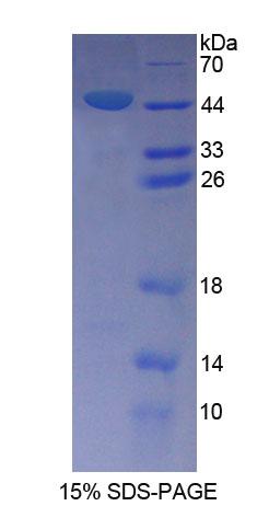 精子關(guān)聯(lián)抗原1(SPAG1)重組蛋白,Recombinant Sperm Associated Antigen 1 (SPAG1)