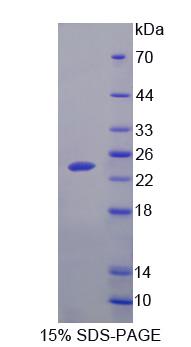 精脒/精胺N1-乙酰基转移酶1(SAT1)重组蛋白,Recombinant Spermidine/Spermine N1-Acetyltransferase 1 (SAT1)