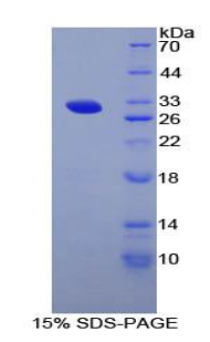 精氨酰氨基肽酶(RNPEP)重组蛋白,Recombinant Aminopeptidase B (RNPEP)