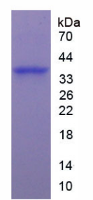 精氨酸酶(ARG)重組蛋白,Recombinant Arginase (ARG)