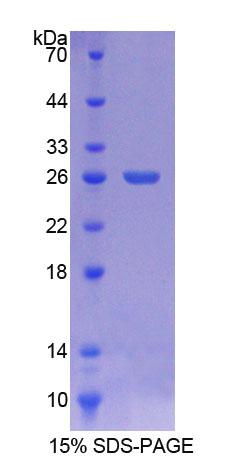 晶状体内膜蛋白2(LIM2)重组蛋白,Recombinant Lens Intrinsic Membrane Protein 2 (LIM2)