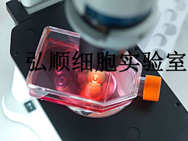 Ishikawa人子宫内膜癌贴壁细胞系,Ishikawa