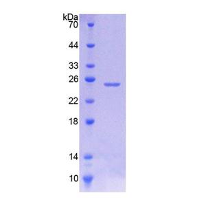 连接蛋白1(JPH1)重组蛋白