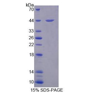 类固醇硫酸酯酶同工酶S(STS)重组蛋白