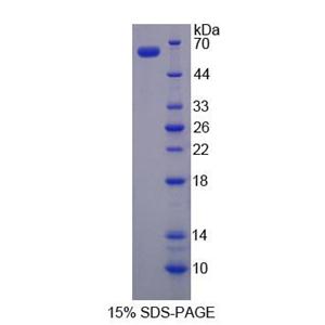 类固醇合成急性调节蛋白(STAR)重组蛋白