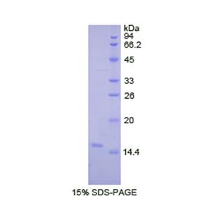 赖氨酰氧化酶样蛋白2(LOXL2)重组蛋白