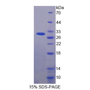 赖氨酸tRNA合成酶(KARS)重组蛋白,Recombinant Lysyl tRNA Synthetase (KARS)