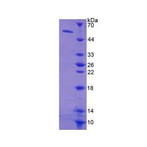 可溶性胸苷激酶1(TK1)重组蛋白,Recombinant Thymidine Kinase 1, Soluble (TK1)