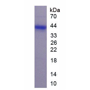 可罗索(KL)重组蛋白,Recombinant Klotho (KL)