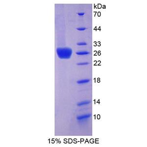柯萨奇病毒腺病毒受体(CXADR)重组蛋白