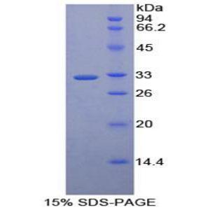 巨噬细胞幼红细胞黏附蛋白(MAEA)重组蛋白,Recombinant Macrophage Erythroblast Attacher (MAEA)