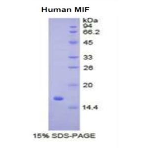 巨噬细胞移动抑制因子(MIF)重组蛋白