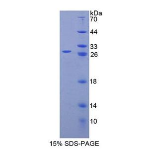 精子蛋白17(Sp17)重组蛋白