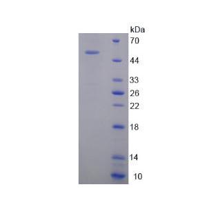 精氨酸/丝氨酸丰富剪接因子2(SRSF2)重组蛋白