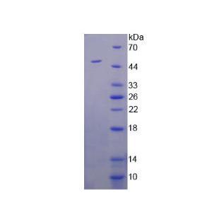 精氨基琥珀酸合成酶1(ASS1)重组蛋白