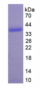 金屬硫蛋白2(MT2)重組蛋白,Recombinant Metallothionein 2 (MT2)