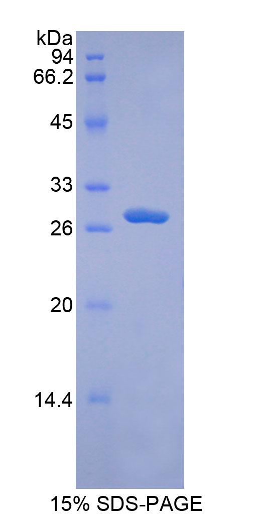 解整合素金属蛋白酶9(ADAM9)重组蛋白,Recombinant A Disintegrin And Metalloprotease 9 (ADAM9)