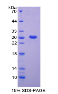 解整合素金属蛋白酶8(ADAM8)重组蛋白,Recombinant A Disintegrin And Metalloprotease 8 (ADAM8)