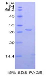 解整合素金属蛋白酶5(ADAM5)重组蛋白,Recombinant A Disintegrin And Metalloprotease 5 (ADAM5)