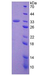 解整合素金屬蛋白酶28(ADAM28)重組蛋白,Recombinant A Disintegrin And Metalloprotease 28 (ADAM28)