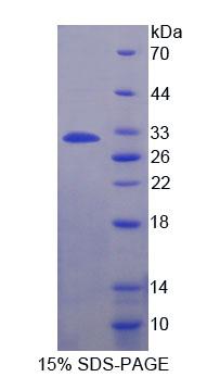 解整合素金屬蛋白酶22(ADAM22)重組蛋白,Recombinant A Disintegrin And Metalloprotease 22 (ADAM22)