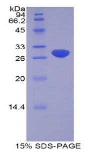 解整合素金属蛋白酶20(ADAM20)重组蛋白,Recombinant A Disintegrin And Metalloprotease 20 (ADAM20)