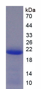 解整合素金属蛋白酶15(ADAM15)重组蛋白,Recombinant A Disintegrin And Metalloprotease 15 (ADAM15)