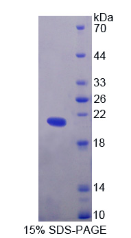 解旋酶样转录因子(HLTF)重组蛋白,Recombinant Helicase Like Transcription Factor (HLTF)