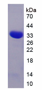 睫状神经营养因子受体(CNTFR)重组蛋白,Recombinant Ciliary Neurotrophic Factor Receptor (CNTFR)