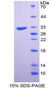 結(jié)構(gòu)特異性識別蛋白1(SSRP1)重組蛋白,Recombinant Structure Specific Recognition Protein 1 (SSRP1)