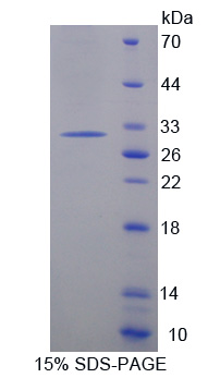 接触蛋白6(CNTN6)重组蛋白,Recombinant Contactin 6 (CNTN6)