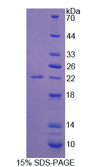 接触蛋白2(CNTN2)重组蛋白,Recombinant Contactin 2 (CNTN2)